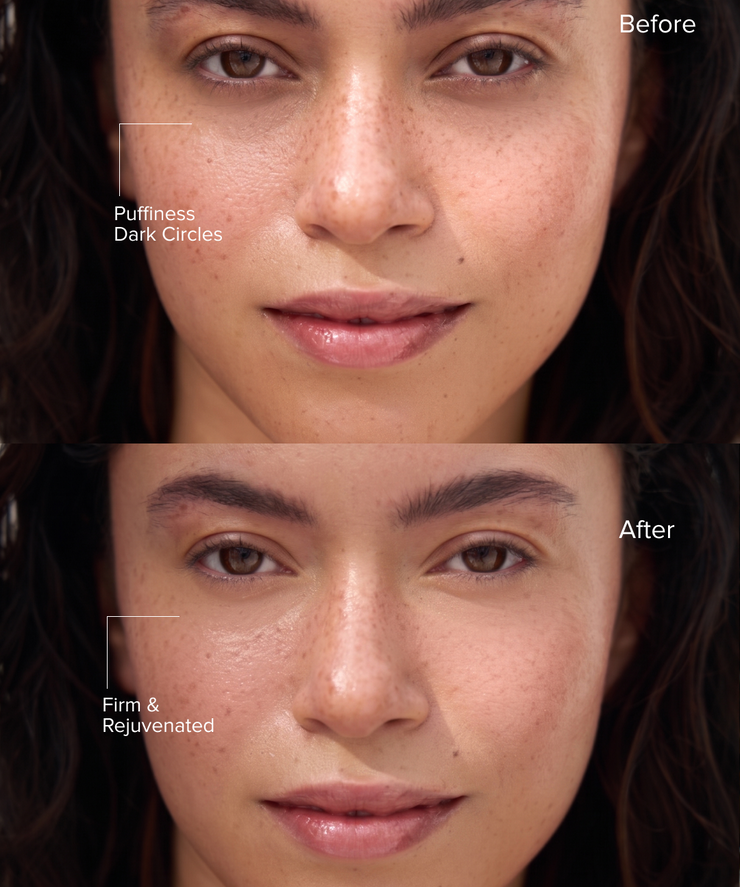 PDRN Duo Wonder Clarifying Serum
