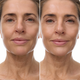 OGB Miracle Skin Tint Medium: voor en na van de skin tint op een model op leeftijd