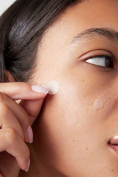 [BYE PIMPLES] Met dit stappenplan verdwijnen puisten ASAP