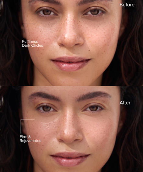Wonder Clarifying Serum